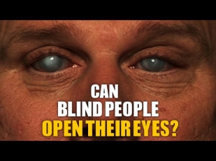 Can Blind People Open Their Eyes?