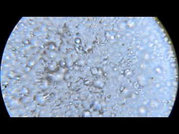 Сперма под микроскопом